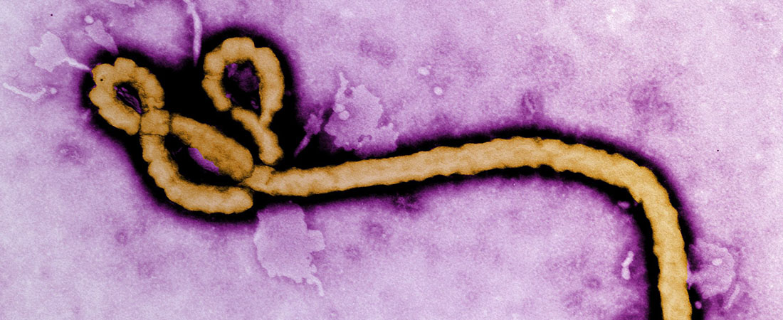 Ebola virus, photo courtesy of the CDC