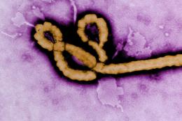Ebola virus, photo courtesy of the CDC